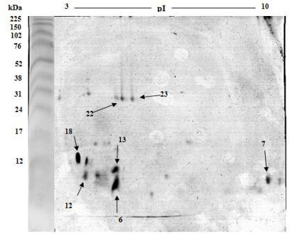 No zimograma, foram testadas varias concentrações de proteína nos EBFCD e EBTCD (5µg, 10µg, 15µg, 20µg, 30µg).