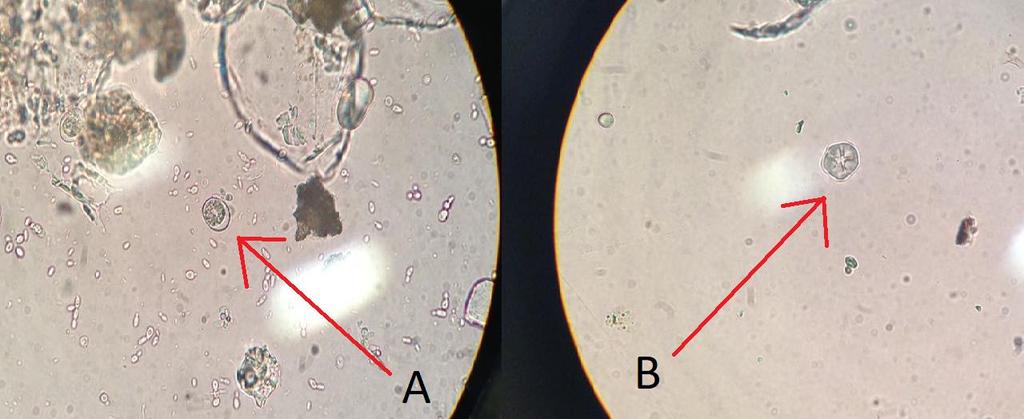 Figura 10: Fotomicrografia óptica das formas parasitárias encontradas nas amostras fecais dos psitacídeos recebidos no CRAS Univap. (A) Eimeria sp., (B) Entamoeba coli.