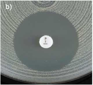 Isolados sensíveis à tetraciclina também são sensíveis à doxiciclina e à minociclina, mas alguns isolados resistentes à tetraciclina podem ser sensíveis à minociclina e/ou à doxiciclina.