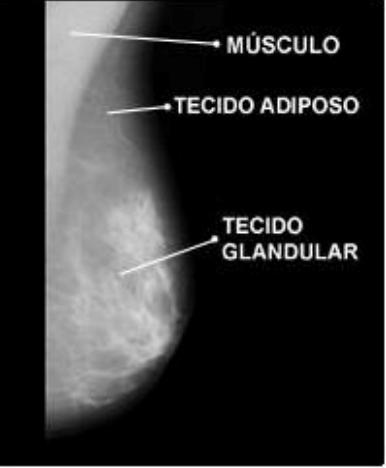 A.6. Mamografia 95 Apesar do auto-exame ser muito importante e de simples realização, a mamografia ainda é a principal ferramenta de diagnóstico, sendo capaz de identificar o tumor antes mesmo dele