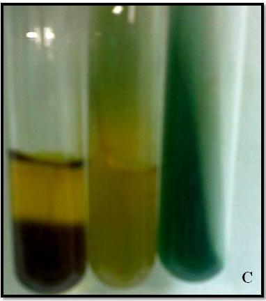 Essa tabela é utilizada para identificação clássica das enterobactérias, além da leitura da fermentação da lactose obtida pelo crescimento da colônia em placa.