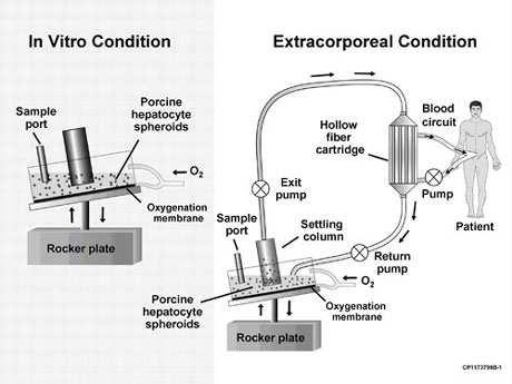 artificial liver or liver