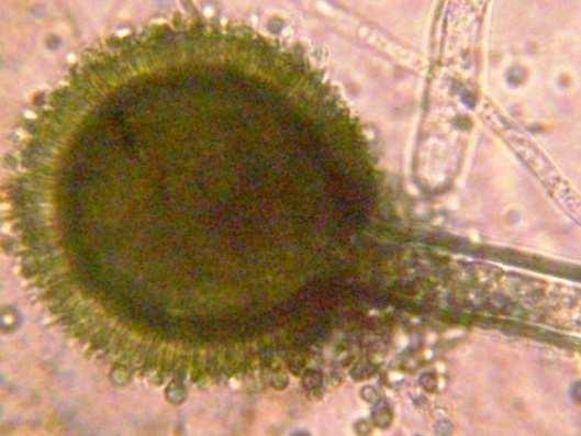 53 Figura 5 Características microscópicas de Aspergillus japonicus A purificação e identificação dos fungos filamentosos foram realizadas no Laboratório de Micologia e Micotoxinas de Alimentos do