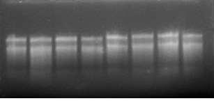 118 1 2 3 4 5 6 7 8 Figura 01. Análise de integridade de RNA extraído pelo método de CTAB em gel de agarose (1%).