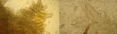 (a) (b) 443 Fotos: Sabrina Suita 444 445 446 Figura 6- Túbulos do hepatopâncreas de pós-larvas de Litopenaeus