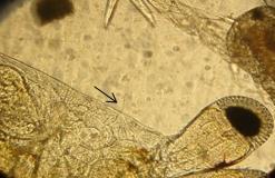 451 Foto: Sabrina Suita 452 453 Figura 8- Fouling epibionte parasitando a carapaça de pós-larva de Litopenaeus vannamei, uma bactéria filamentosa é indicada pela seta.