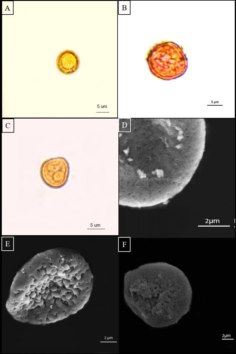 Figura 3: Fotomicrografias e eletromicrografias dos esporos das espécies de Amphidium Schimp. estudadas: A e F: A. mougeotii (Bruch & Schimp.) Schimp.; B, D e E: A.