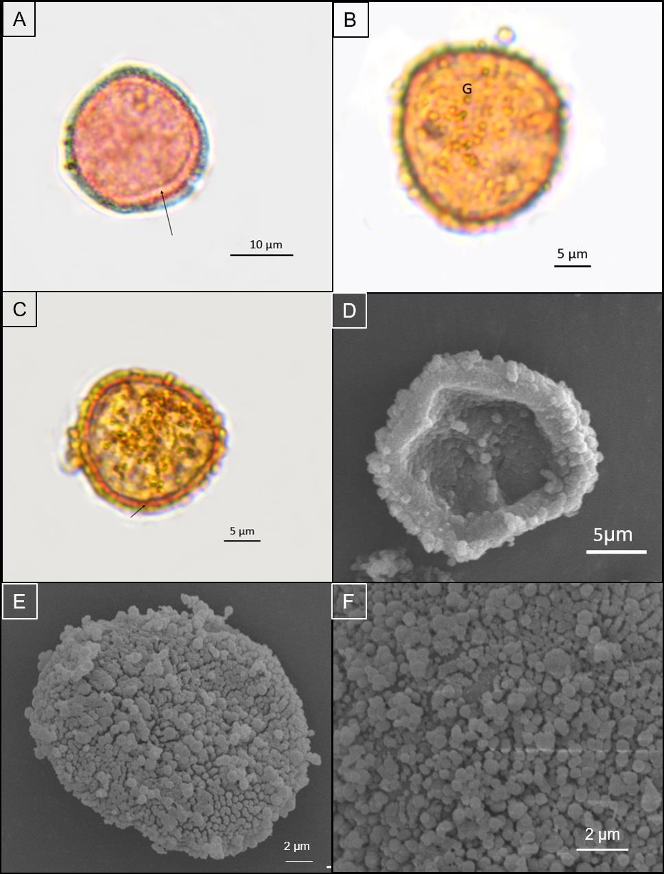 Figura 3: Micrografias e eltromicrografias das espécies do Tipo Gemoide.