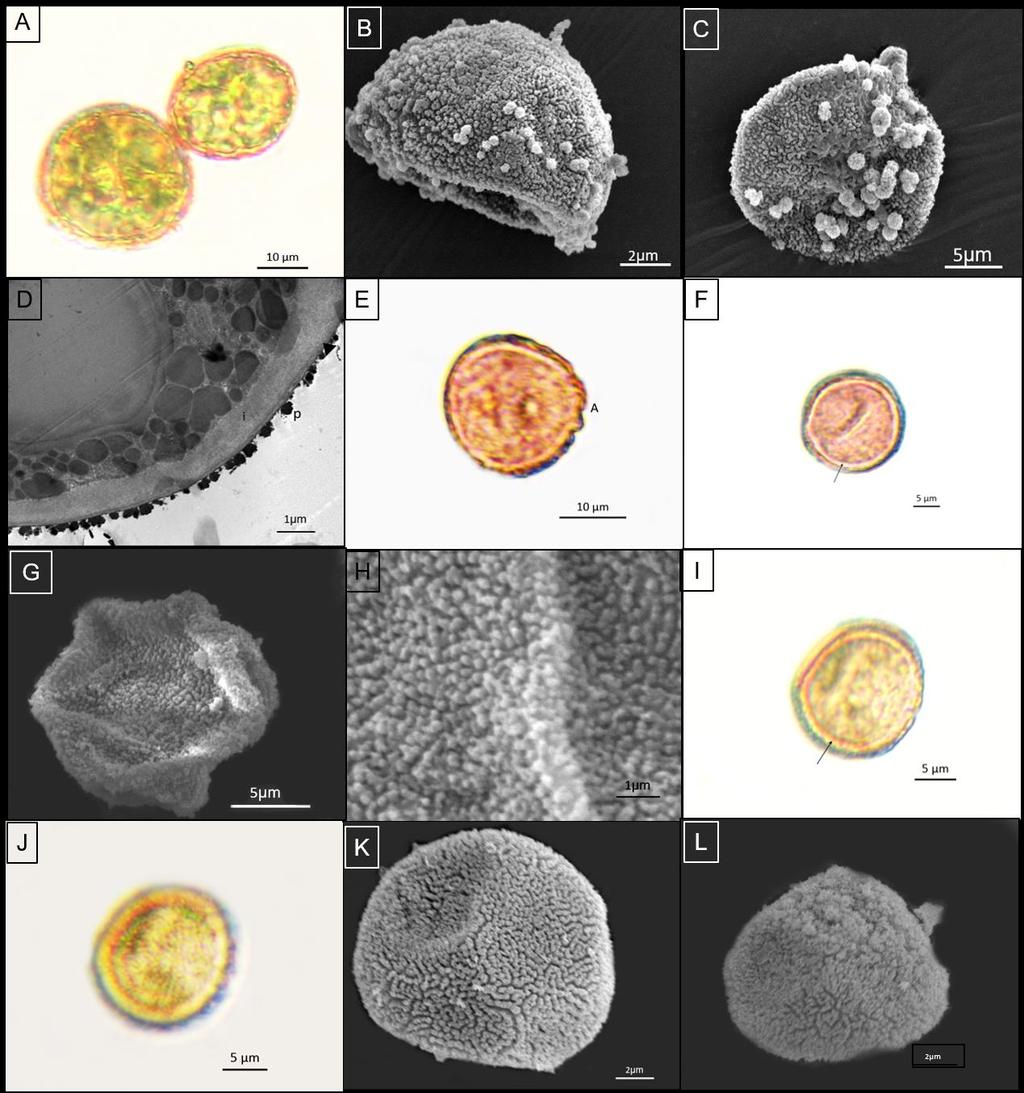 Figura 10: Fotomicrografias e eletromicrografias das espécies anisospóricas do Tipo granuloide. A, B, C e D: Arctoa hyperborea (Gunnerus ex With.) Bruch & Schimp.
