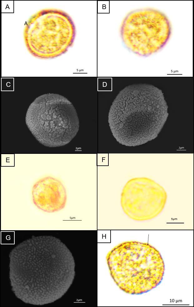 Figura 13: Fotomicrografias e eletromicrografias das espécies isospóricas do Tipo baculoide. A, B, C e D: Dicranoweisia cirrata (Hedw.) Lindb. ex Milde; E; Dicranoweisia crispula (Hedw.