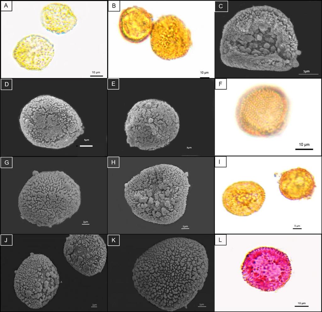 Figura 17: Micrografias das espécies anisospóricas do Tipo Baculoide. A: Cynodontium gracilescens (F. Weber & D. Mohr) Schimp., B-E: Cynodontium polycarpum (Hedw.) Schimp., F-H: Cynodontium tenellum (Shimp.