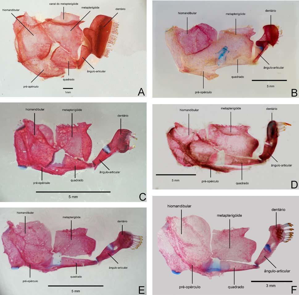 Figura 3 - Suspensório e arco mandibular em vista lateral.