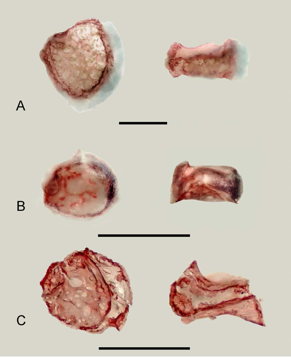 1 mm Figura 7 - Detalhe do quarto faringobranquial em vista dorsal à esquerda e vista lateral à direita. A: Limatulichthys sp.
