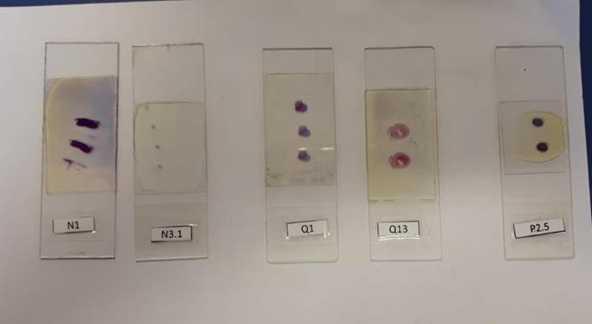 d) Microtomia e distensão dos cortes: os blocos resultantes da inclusão dos materiais em parafina, são cortados com uso de navalhas de aço descartáveis no micrótomo.