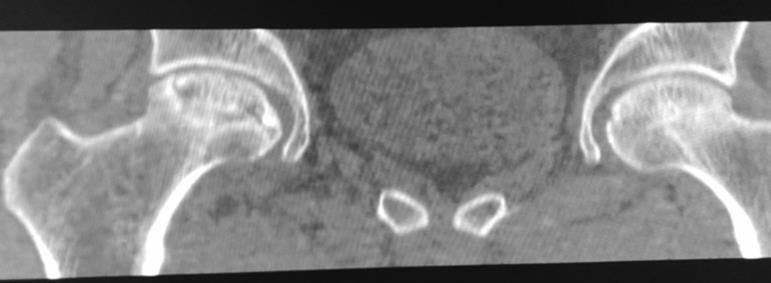 Axial 3D  multiplanar