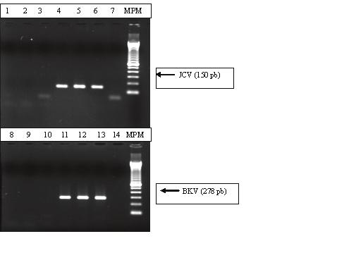 Limite de detecção da Nested-PCR o percentual de positividade.