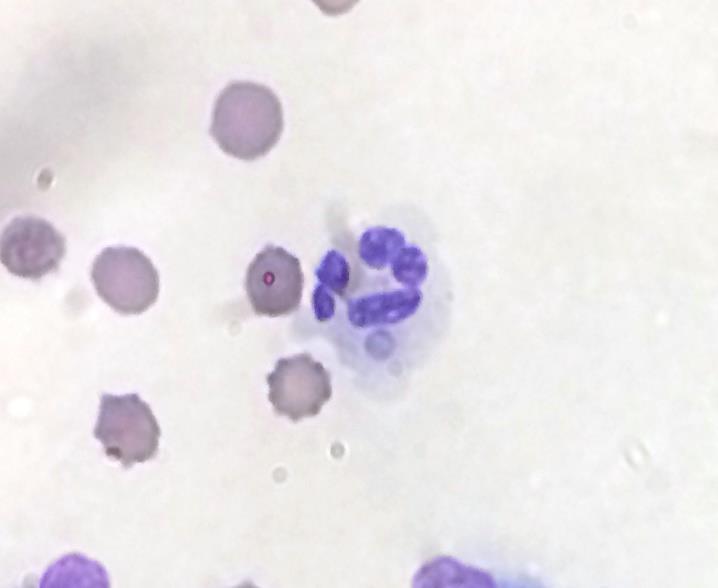 granulocytes (neutrophils and