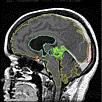 Medicina Construção de Modelos Tridimensionais As estruturas