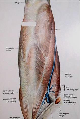 Expôs-se a aponeurose do músculo vasto lateral da coxa, na qual se demarcou retângulo de 2cm de largura e 6cm de comprimento, medida padrão utilizada para compor a alça do sling (Figura 2). Figura 2.