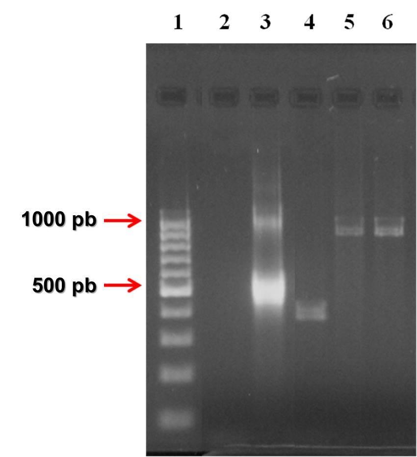 Figura 9 - Nested-PCR da região ITS-1 em gel de agarose 2%, a partir de amostras primárias de musculatura esquelética de roedores silvestres do Rio Grande do Sul.