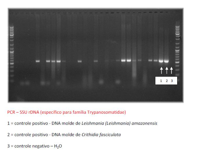 41 6 RESULTADOS Foram analisadas amostras de 93 pacientes, todas submetidas aos dois métodos moleculares propostos.