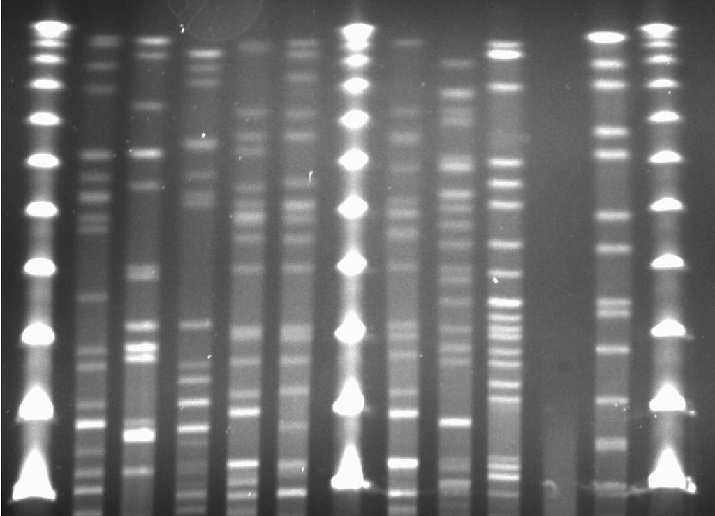 56 3.3. VARIABILIDADE GENÉTICA DAS E. coli DIARREIOGÊNICAS Na análise do perfil de macrorrestrição cromossômica pela enzima Xba I foram tipadas 70 das 72 E. coli diarreiogênicas identificadas.