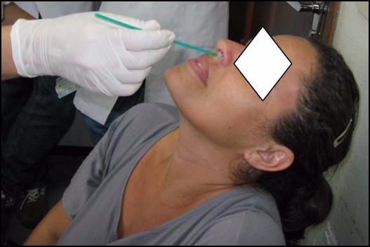 25 Figura 2: Raspado de mucosa nasal por meio de escova flexível tipo swab, esfregando-se sobre o septo nasal pela fossa nasal esquerda. CREDESH/HC/FAMED/UFU, 2010.