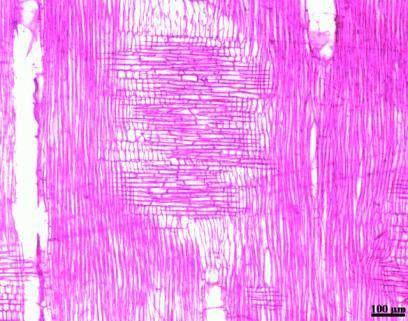 (1975): Sendo, Ep: Espessura de parede, em µm; Lf: Largura de fibra, em µm. 3. RESULTADOS E DISCUSSÃO 3.1 Tetragastris altíssima (Breu-manga) Parênquima Parênquima Paratraqueal unilateral (Figura 1a).