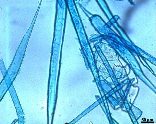 librifomes; muito curtas (0,9 mm), variando de 0,6 a 1,23 mm; sua largura é média (21,67m), variando de 16,18 a 28,83 µm;