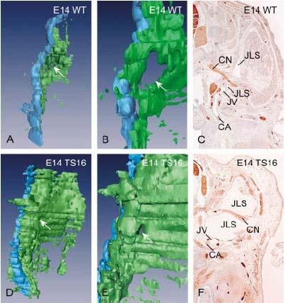 Revisão da Literatura 29 Figura 13 Reconstrução tridimensional da veia jugular (azul) e do saco linfático (verde), durante o 14 o dia embrionário (E14), comparando o rato do tipo selvagem (WT) com o