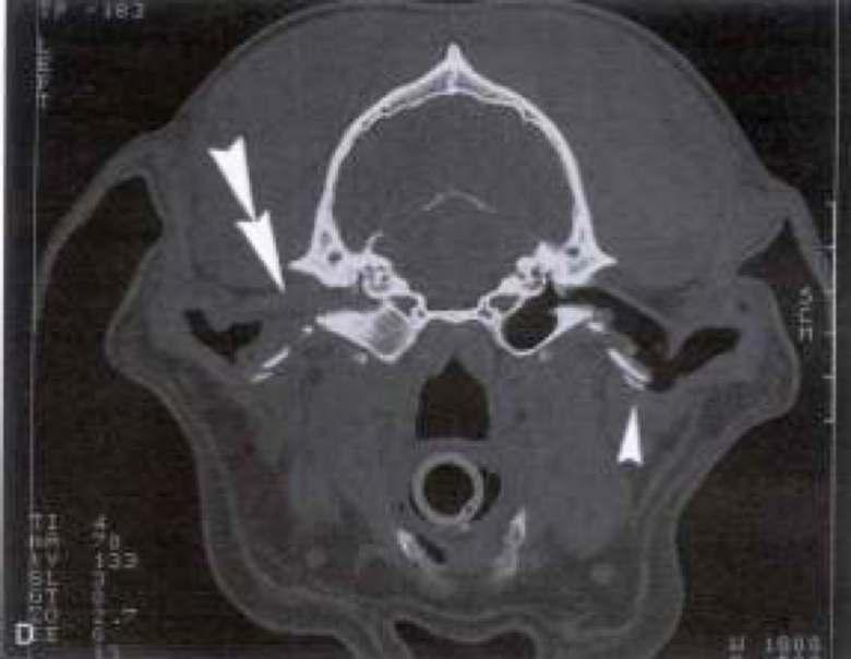 Advanced imaging techniques.