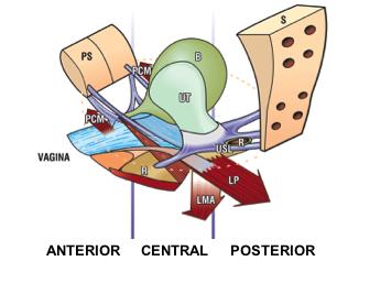 15 onde as estruturas que determinam a posição uretral e da parede vaginal anterior são as mesmas (DELANCEY, 1992).