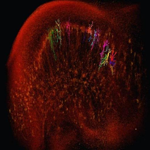 Foi o que cientistas brasileiros conseguiram ao unir microtomografia de raio-x feita a partir de um acelerador de partículas com uma técnica já conhecida de marcação de células neuronais.