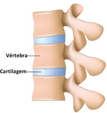 TECIDO CONJUNTIVO DE SUSTENTAÇÃO CARTILAGINOSO Rígido, flexível