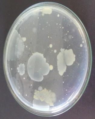 TABELA 1 - Resultado da análise microbiológica nas amostras de água de lavagem couve in natura com e sem