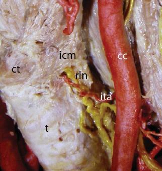 inferior NLR anterior