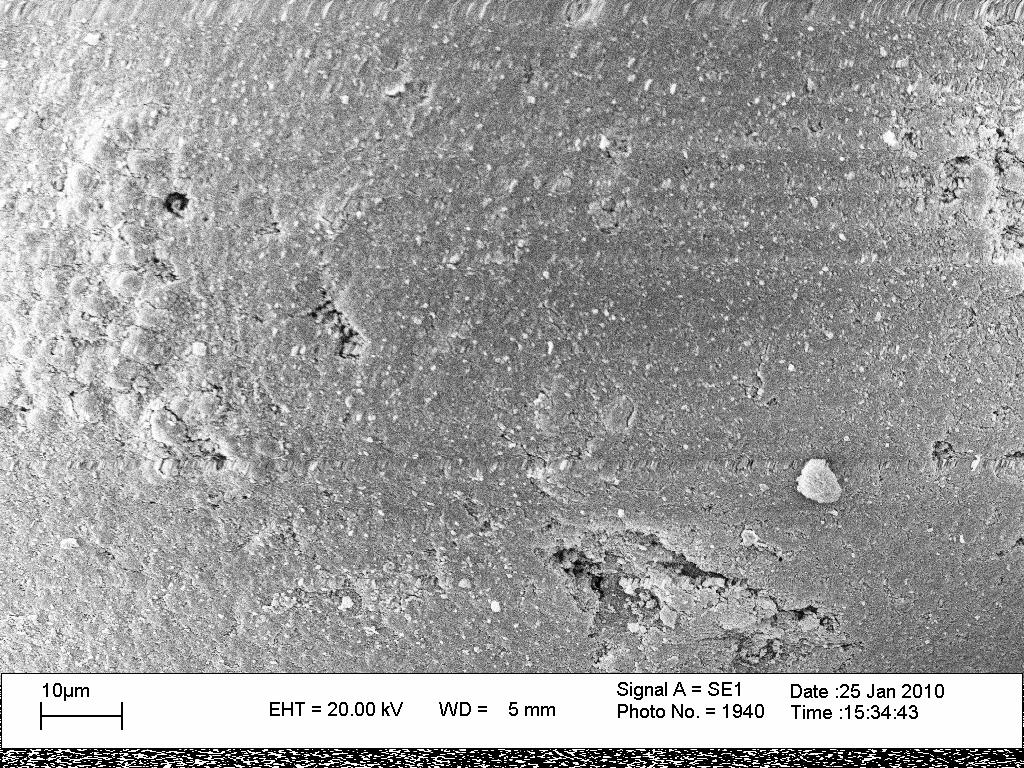 103 As micrografias de microscopia eletrônica de varredura mostram os perfis da superfície externa e interna do copolímero sintetizado com velocidade de 500 RPM