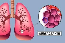 O surfactante é um fosfolipídio que diminui a tensão superficial dos fluidos pulmonares e evita o colapso alveolar ao final da