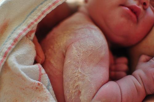 K Sistema Tegumentar O recém-nascido saudável é úmido e quente ao toque.