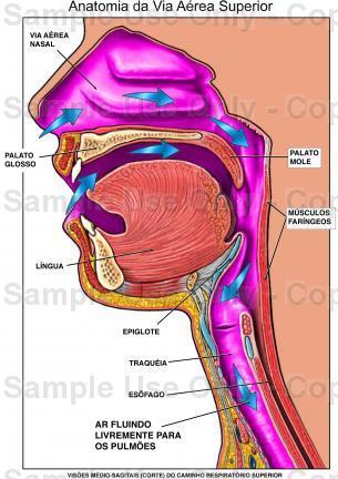 Obesidade DisMalformações craniofaciais Doenças síndromáticas (T21,.