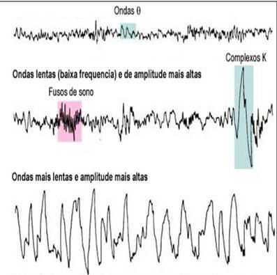 Arquitectura do sono Fase NREM EEG Fase REM (Rapid eye movement) EEG