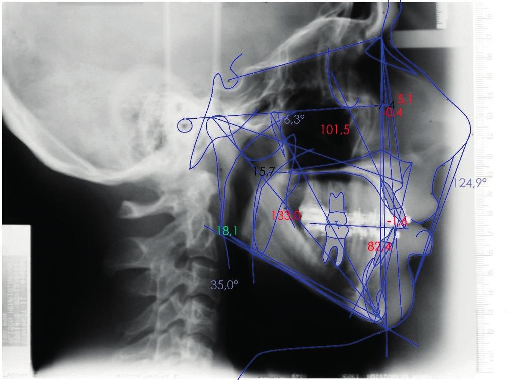 de 50 pontos anatômicos dessas radiografias, utilizando-se os programas Imaging e.