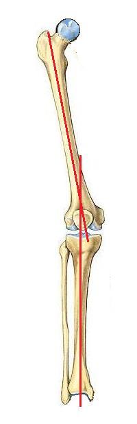 16 Figura 4 - Eixo anatômico Fonte: Próprio autor Em um joelho normal, a superfície articular tibial está em aproximadamente 3 de varo em relação ao eixo mecânico e a superfície articular femoral