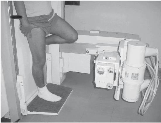 21 Figura 9 - Posicionamento do paciente em apoio monopodal para a realização do exame nos centros de imagem.