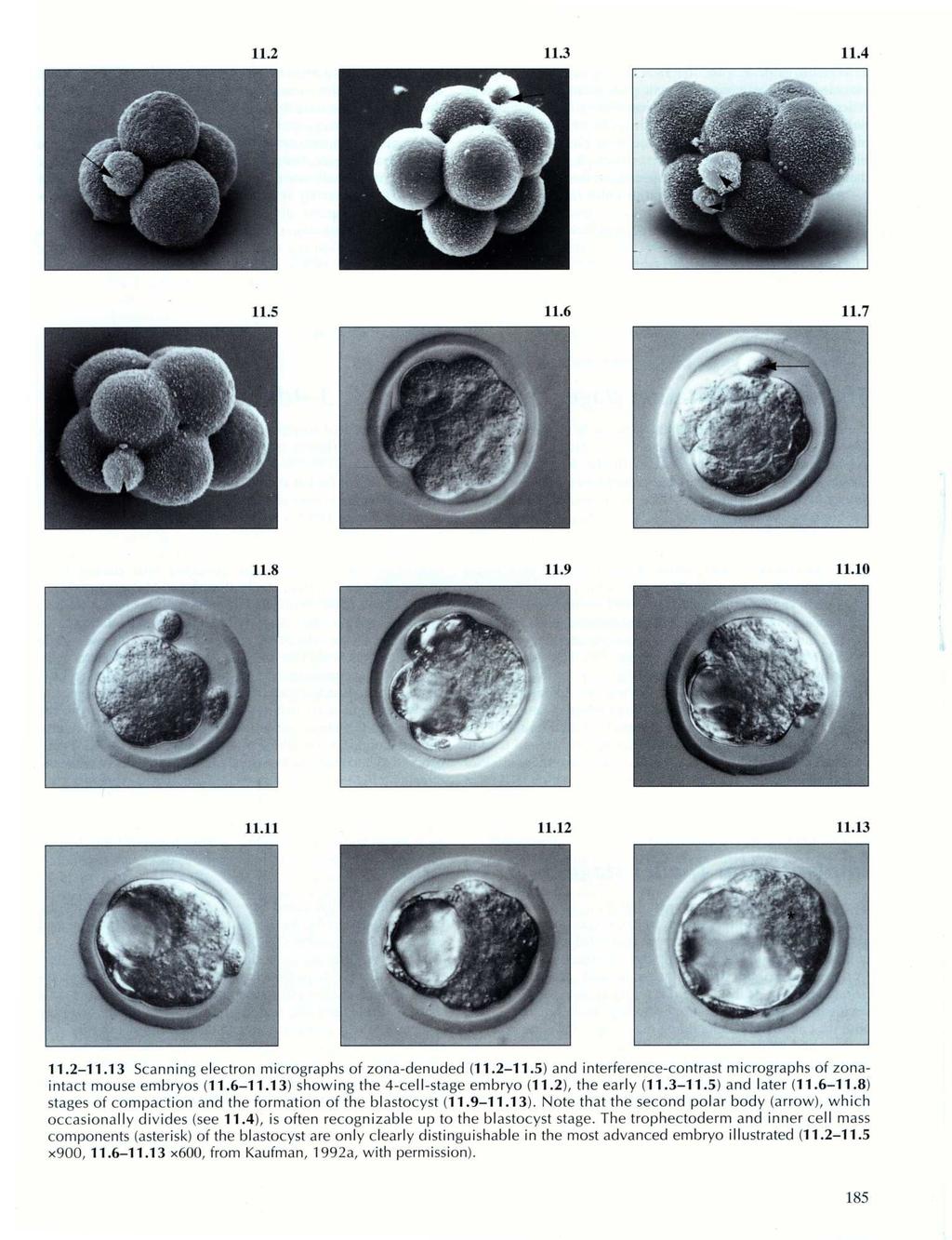 blastocisto de mamífero contêm MASSA CELULAR INTERNA que formará o embrião