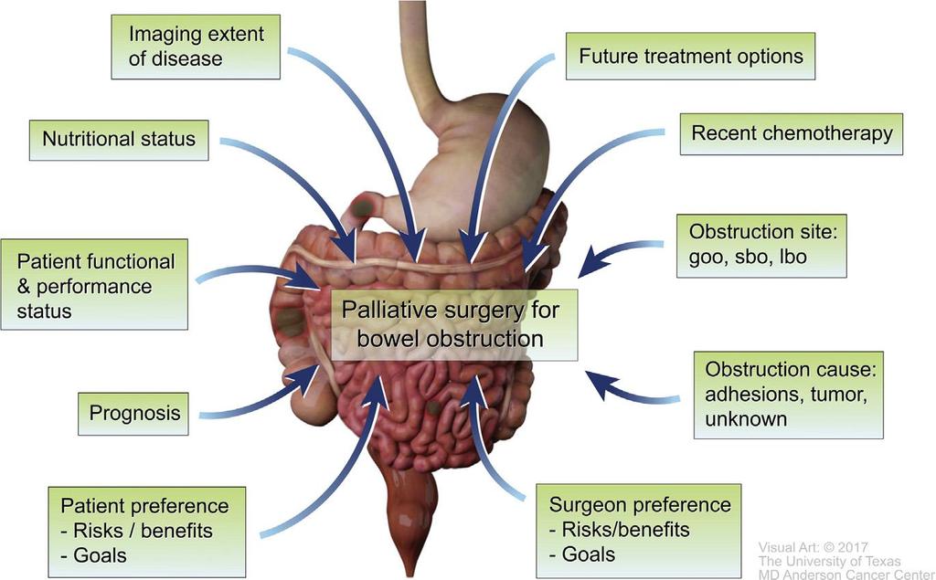 OCLUSÃO INTESTINAL tratamento Pujara et al 2017 Figure 3.