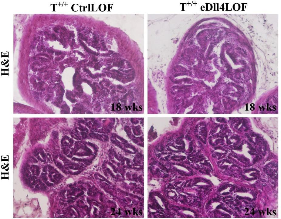III. RESULTADOS A análise histológica por coloração hematoxilina-eosina das criosecções da próstata dos murganhos T +/+ edll4lof e T +/+ CtrlLOF não revelou diferenças consideráveis no grau de lesões