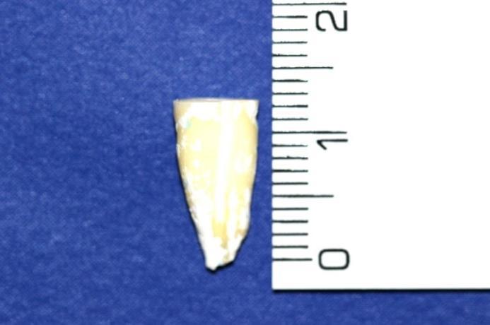 um comprimento médio de 13 mm estabelecido visualmente com régua plástica milimetrada (Angelus Indústria de produtos odontológicos S/A, Londrina-PR,