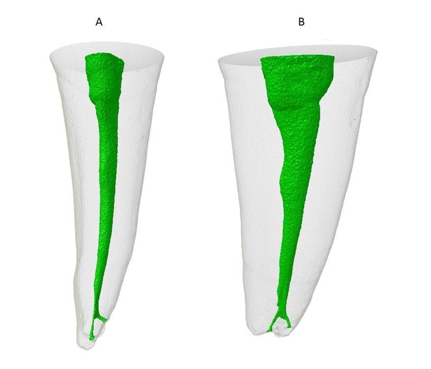 As características morfométricas 2D foram realizadas no programa CTAn v.2.0 (Brucker MicroCT, Kontich, Bélgica).