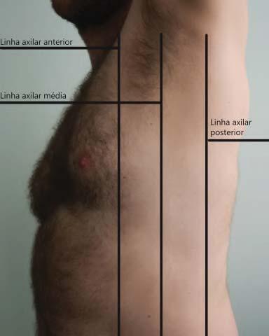 Foto: arquivo dos autores. ângulo inferior das escápulas e em paralelo à linha medioespinal, sendo demarcadas com os membros superiores junto ao corpo (Fig. 9-4 ).